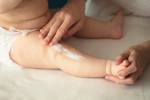 A Diaper Rash Ointment and Balm as a Protective Measure